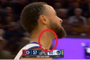  库里：血痕是之前打湖人那场留下的 看起来要比实际情况严重